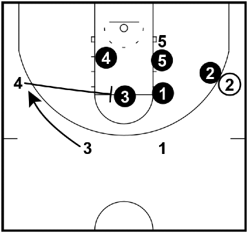 Flare screen - weak side Flare screen - weak side